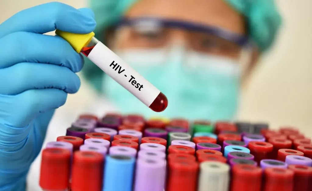 HIV/AIDS