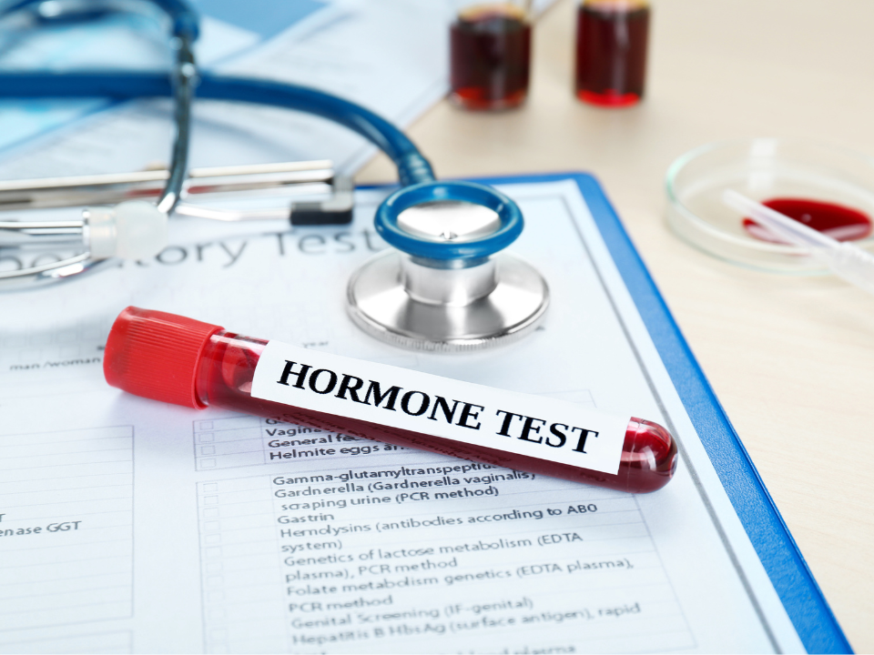 Desequilíbrio hormonal e seus impactos na saúde testes hormonais