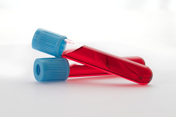 Sangue: o líquido vital que mantém o corpo em funcionamento tubos de ensaio com sangue
